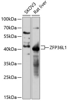 Western blot analysis of extracts of various cell lines using ZFP36L1 Polyclonal Antibody at 1:3000 dilution.