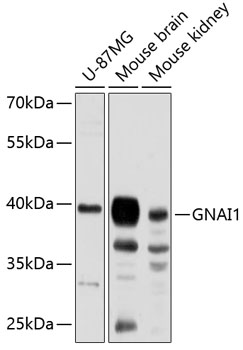 Western blot analysis of extracts of various cell lines using GNAI1 Polyclonal Antibody at 1:3000 dilution.