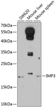 Western blot analysis of extracts of various cell lines using IMP3 Polyclonal Antibody at 1:1000 dilution.