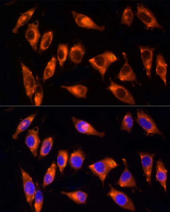 Immunofluorescence analysis of L929 cells using NPHP4 Polyclonal Antibody at dilution of 100 (40x lens). Blue: DAPI for nuclear staining.