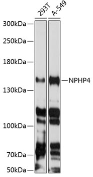 Western blot analysis of extracts of various cell lines using NPHP4 Polyclonal Antibody at 1:3000 dilution.