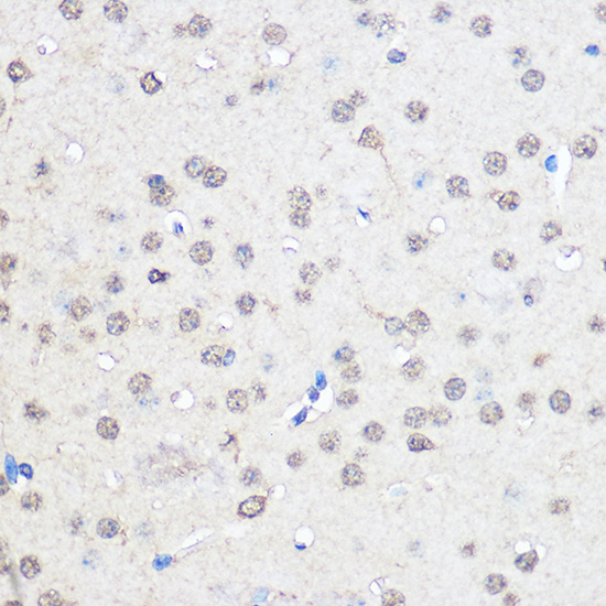 Immunohistochemistry of paraffin-embedded Mouse brain using CNOT7 Polyclonal Antibody at dilution of 1:50 (40x lens).Perform microwave antigen retrieval with 10 mM PBS buffer pH 7.2 before commencing with IHC staining protocol.