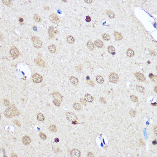 Immunohistochemistry of paraffin-embedded Rat brain using CNOT7 Polyclonal Antibody at dilution of 1:50 (40x lens).Perform microwave antigen retrieval with 10 mM PBS buffer pH 7.2 before commencing with IHC staining protocol.