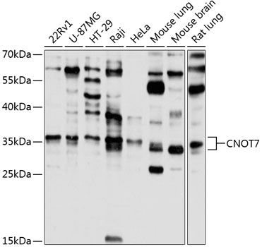 Western blot analysis of extracts of various cell lines using CNOT7 Polyclonal Antibody at 1:1000 dilution.