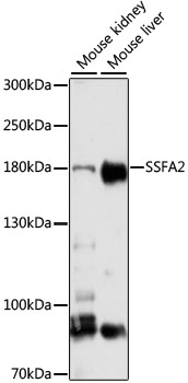 Western blot analysis of extracts of various cell lines using SSFA2 Polyclonal Antibody at 1:3000 dilution.