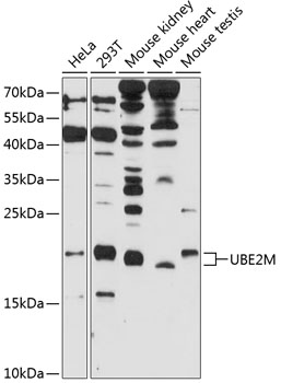 Western blot analysis of extracts of various cell lines using UBE2M Polyclonal Antibody at 1:1000 dilution.