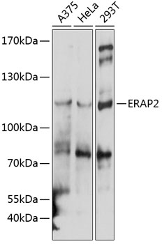 Western blot analysis of extracts of various cell lines using ERAP2 Polyclonal Antibody at 1:1000 dilution.