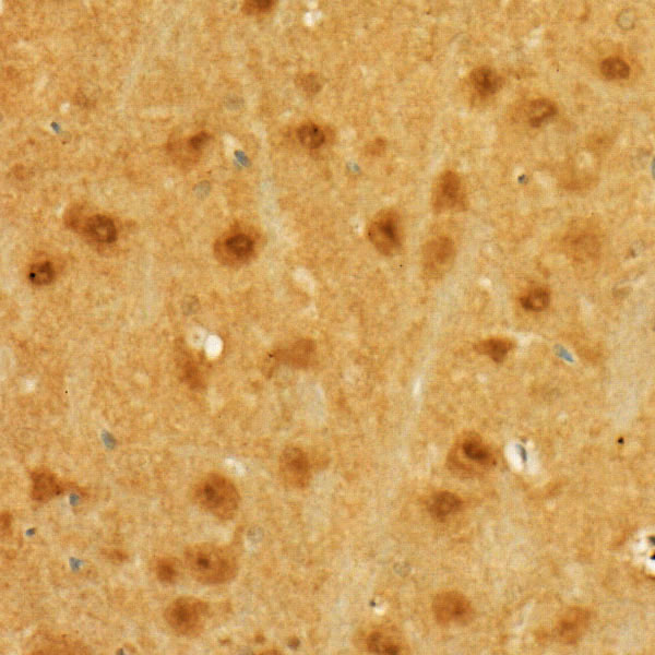 Immunohistochemistry of paraffin-embedded rat brain using MGEA5 Polyclonal Antibody at dilution of 1:50 (40x lens).Perform high pressure antigen retrieval with 10 mM citrate buffer pH 6.0 before commencing with IHC staining protocol.