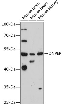 Western blot analysis of extracts of various cell lines using DNPEP Polyclonal Antibody at 1:3000 dilution.