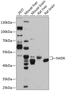 Western blot analysis of extracts of various cell lines using NADK Polyclonal Antibody at 1:1000 dilution.