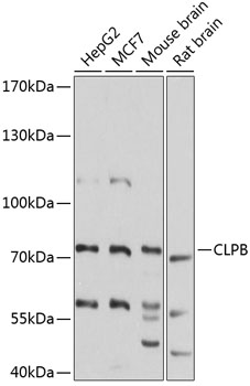 Western blot analysis of extracts of various cell lines using CLPB Polyclonal Antibody at 1:3000 dilution.