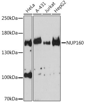 Western blot analysis of extracts of various cell lines using NUP160 Polyclonal Antibody at1:3000 dilution.