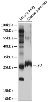 Western blot analysis of extracts of various cell lines using IYD Polyclonal Antibody at 1:1000 dilution.