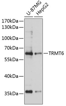 Western blot analysis of extracts of various cell lines using TRMT6 Polyclonal Antibody at 1:3000 dilution.