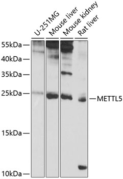 Western blot analysis of extracts of various cell lines using METTL5 Polyclonal Antibody at 1:1000 dilution.