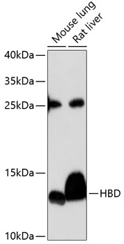 Western blot analysis of extracts of various cell lines using HBD Polyclonal Antibody at 1:3000 dilution.