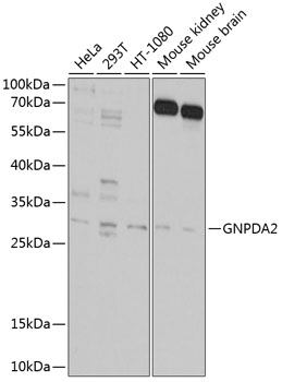 Western blot analysis of extracts of various cell lines using GNPDA2 Polyclonal Antibody at 1:1000 dilution.