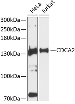 Western blot analysis of extracts of various cell lines using CDCA2 Polyclonal Antibody at 1:3000 dilution.