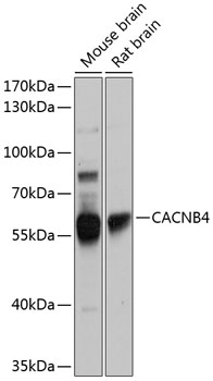 Western blot analysis of extracts of various cell lines using CACNB4 Polyclonal Antibody at 1:1000 dilution.