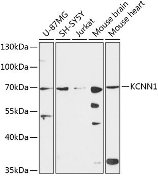 Western blot analysis of extracts of various cell lines using KCNN1 Polyclonal Antibody at 1:3000 dilution.