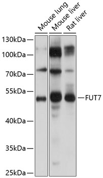 Western blot analysis of extracts of various cell lines using FUT7 Polyclonal Antibody at 1:1000 dilution.