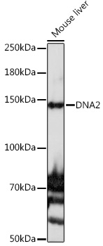 Western blot analysis of extracts of Mouse liver using DNA2 Polyclonal Antibody at 1:1000 dilution.