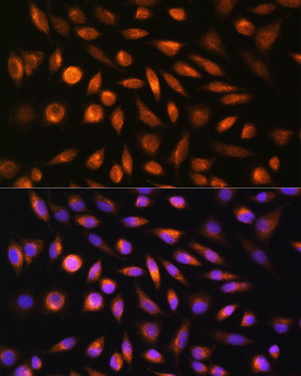 Immunofluorescence analysis of L929 cells using SH3PXD2A Polyclonal Antibody at dilution of 1:100. Blue: DAPI for nuclear staining.