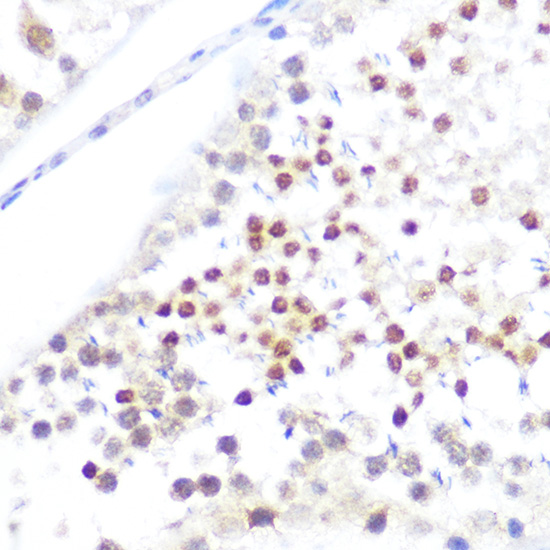 Immunohistochemistry of paraffin-embedded rat testis using NUP50 Polyclonal Antibody at dilution of 1:100 (40x lens).Perform microwave antigen retrieval with 10 mM Tris/EDTA buffer pH 9.0 before commencing with IHC staining protocol.