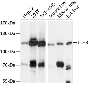 Western blot analysis of extracts of various cell lines using ITIH3 Polyclonal Antibody at 1:3000 dilution.