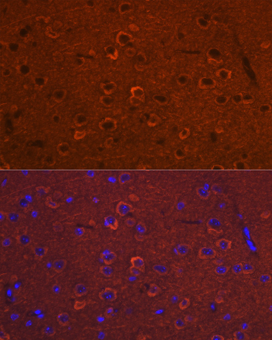 Immunofluorescence analysis of Mouse brain using DCAMKL1/DCLK1 Polyclonal Antibody at dilution of 1:100 (40x lens). Blue: DAPI for nuclear staining.