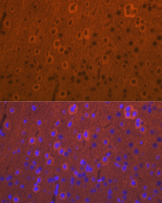 Immunofluorescence analysis of mouse brain cells using DCAMKL1/DCLK1 Polyclonal Antibody at dilution of 1:100 (40x lens). Blue: DAPI for nuclear staining.