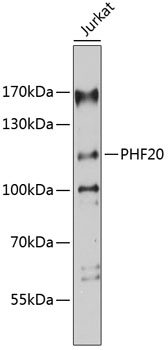 Western blot analysis of extracts of Jurkat cells using PHF20 Polyclonal Antibody at 1:3000 dilution.