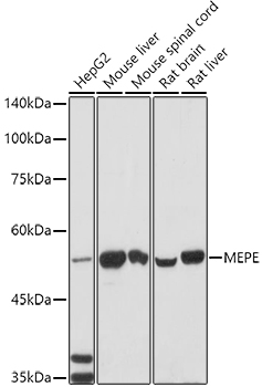 Western blot analysis of extracts of various cell lines using MEPE Polyclonal Antibody at 1:1000 dilution.