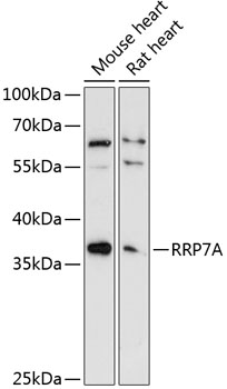 Western blot analysis of extracts of various cell lines using RRP7A Polyclonal Antibody at 1:3000 dilution.