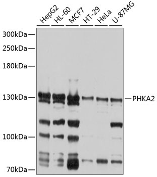 Western blot analysis of extracts of various cell lines using PHKA2 Polyclonal Antibody at 1:1000 dilution.