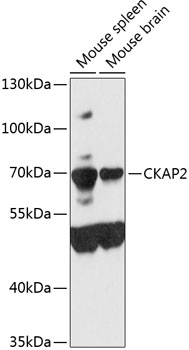 Western blot analysis of extracts of various cell lines using CKAP2 Polyclonal Antibody at 1:3000 dilution.