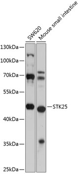 Western blot analysis of extracts of various cell lines using STK25 Polyclonal Antibody at 1:1000 dilution.