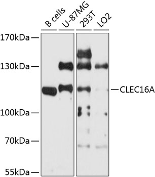 Western blot analysis of extracts of various cell lines using CLEC16A Polyclonal Antibody at 1:1000 dilution.