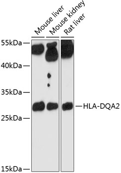 Western blot analysis of extracts of various cell lines using HLA-DQA2 Polyclonal Antibody at 1:3000 dilution.