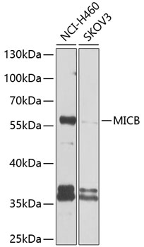 Western blot analysis of extracts of various cell lines using MICB Polyclonal Antibody at 1:1000 dilution.