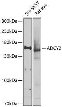 Western blot analysis of extracts of various cell lines using ADCY2 Polyclonal Antibody at 1:1000 dilution.