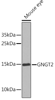 Western blot analysis of extracts of Mouse eye using GNGT2 Polyclonal Antibody at1:1000 dilution.