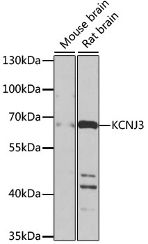 Western blot analysis of extracts of various cell lines using KCNJ3 Polyclonal Antibody at 1:1000 dilution.