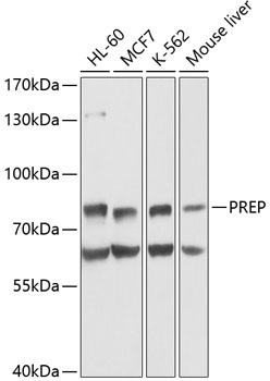 Western blot analysis of extracts of various cell lines using PREP Polyclonal Antibody at 1:1000 dilution.