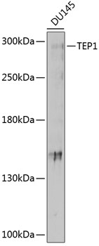 Western blot analysis of extracts of DU145 cells using TEP1 Polyclonal Antibody at 1:1000 dilution.