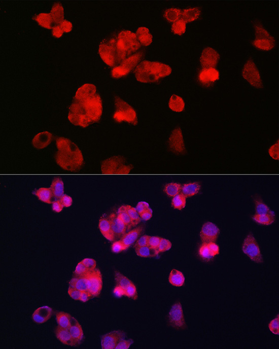 Immunofluorescence analysis of HepG2 cells using TFR2 Polyclonal Antibody at dilution of 1:100 (40x lens). Blue: DAPI for nuclear staining.