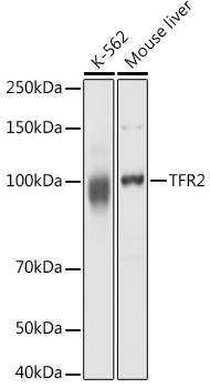 Western blot analysis of extracts of various cell lines using TFR2 Polyclonal Antibody at 1:1000 dilution.