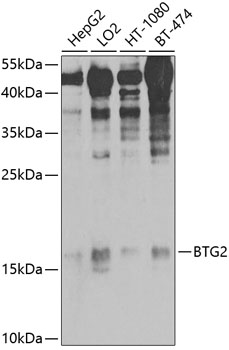 Western blot analysis of extracts of various cell lines using BTG2/PC3 Polyclonal Antibody at 1:1000 dilution.