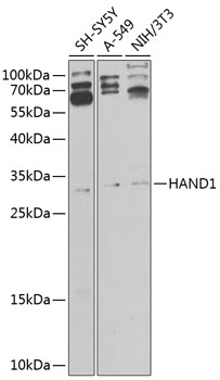 Western blot analysis of extracts of various cell lines using HAND1 Polyclonal Antibody at 1:1000 dilution.