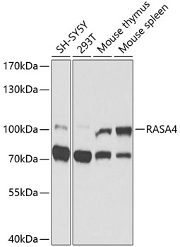 Western blot analysis of extracts of various cell lines using RASA4 Polyclonal Antibody at 1:1000 dilution.